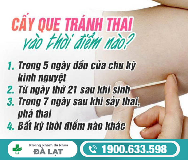 CẤY QUE TRÁNH THAI VÀO THỜI ĐIỂM NÀO AN TOÀN?