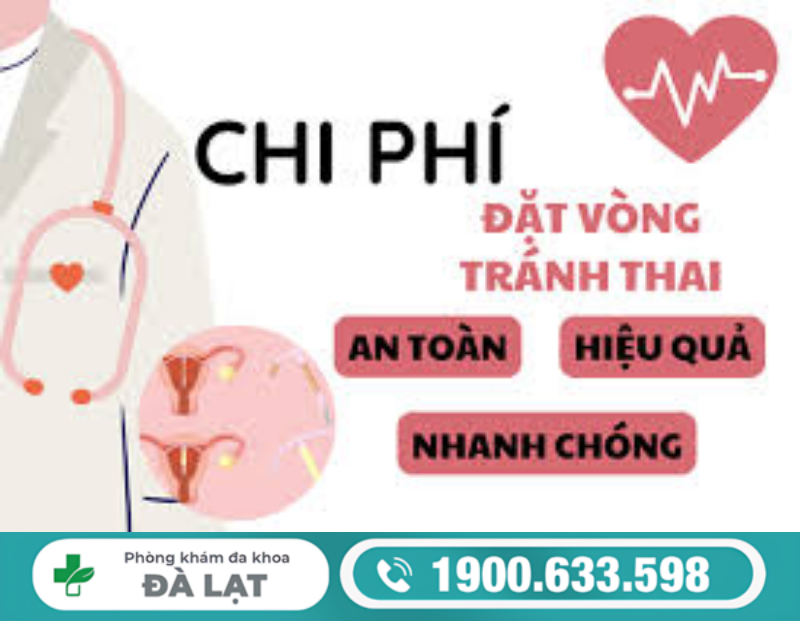 CHI PHÍ ĐẶT VÒNG TRÁNH THAI HIỆN NAY HẾT BAO NHIÊU?