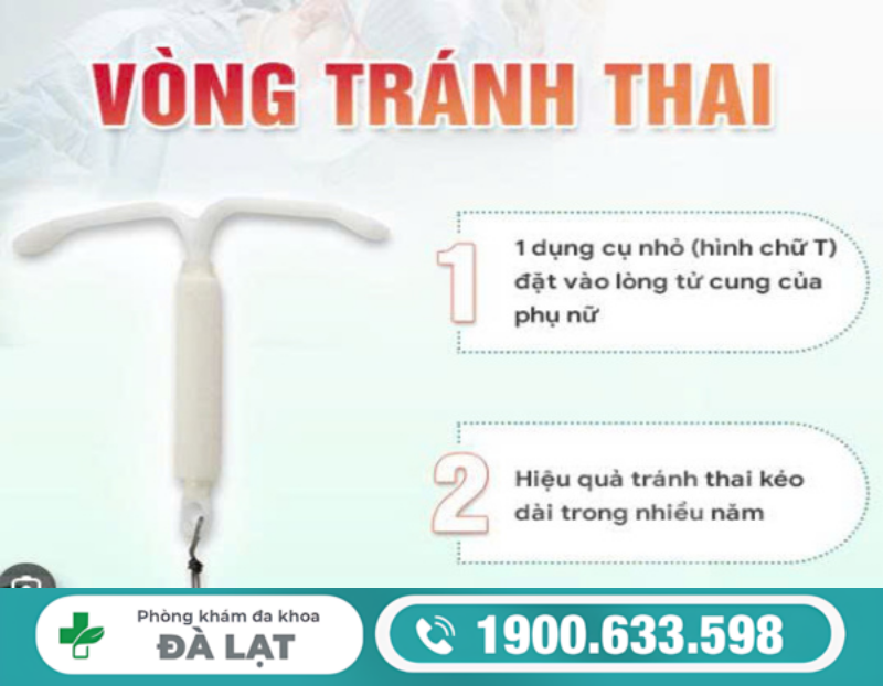 CÁCH ĐẶT VÒNG TRÁNH THAI AN TOÀN VÀ HIỆU QUẢ CHO NỮ GIỚI 