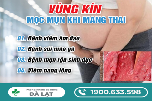 Nổi Mụn Ở Vùng Kín Nữ Giới Khi Mang Thai 