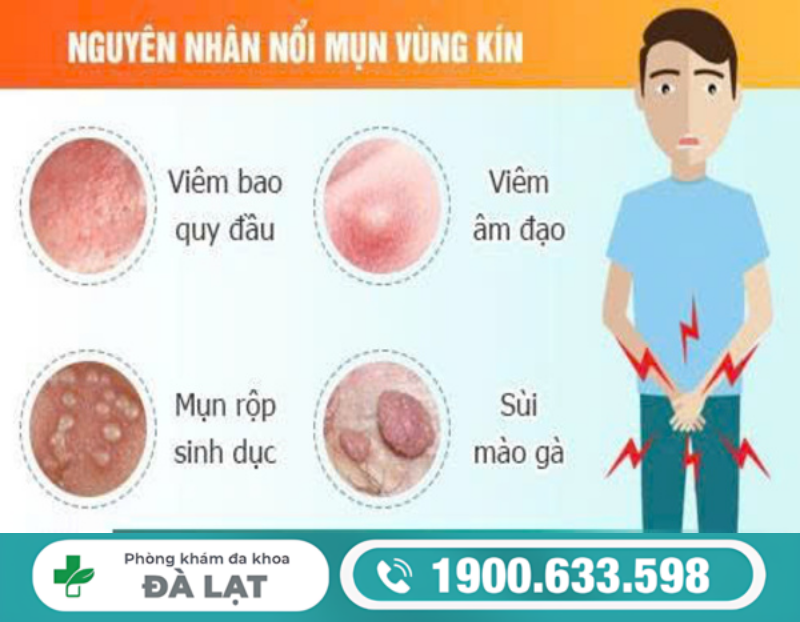 MỤN RỘP Ở VÙNG KÍNH NỮ CẢNH BÁO BỆNH GÌ?