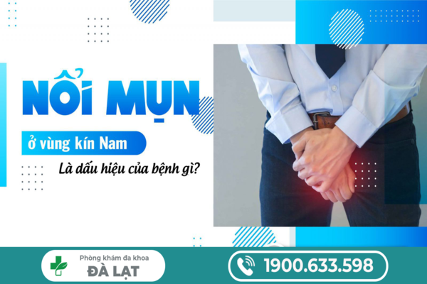 Mụn Sinh Dục Ở Vùng Kín Nam Là Gì? 