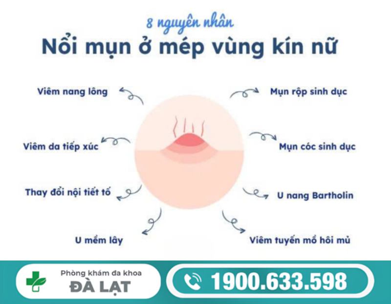 NỔI MỤN TRỨNG CÁ Ở VÙNG KÍN NỮ LÀ BỆNH GÌ?