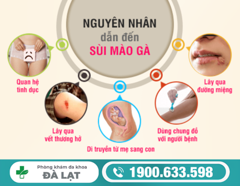 NGUYÊN NHÂN PHỔ BIẾN GÂY U NHÚ SINH DỤC 