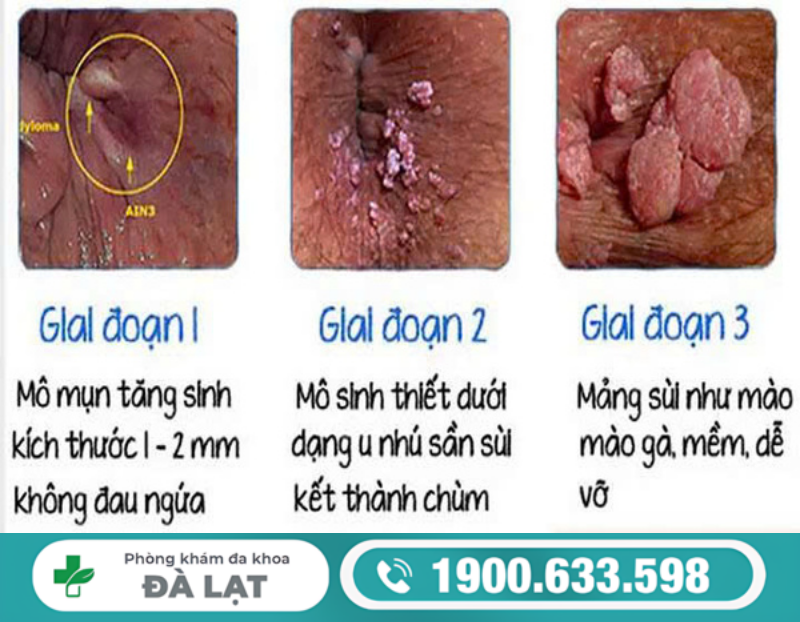 MÔI BÉ BỊ SẦN LÀ DẤU HIỆU BỆNH GÌ?