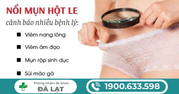 Nổi Mụn Ở Hột Le: Nguyên Nhân, Dấu Hiệu, Biến Chứng và Cách Điều Trị 