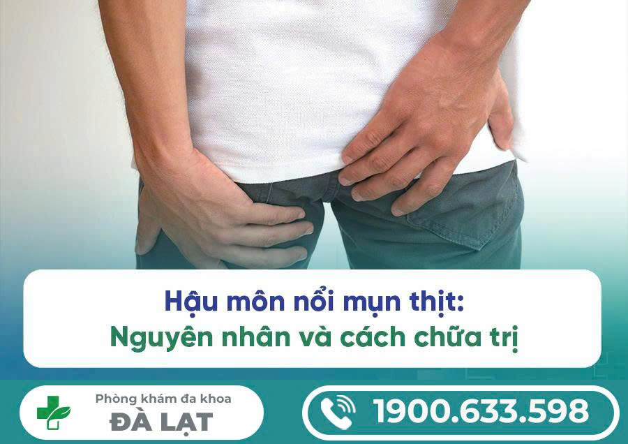 Hậu Môn Nổi Mụn Thịt Là Gì? Nguyên Nhân, Biến Chứng và Cách Điều Trị 