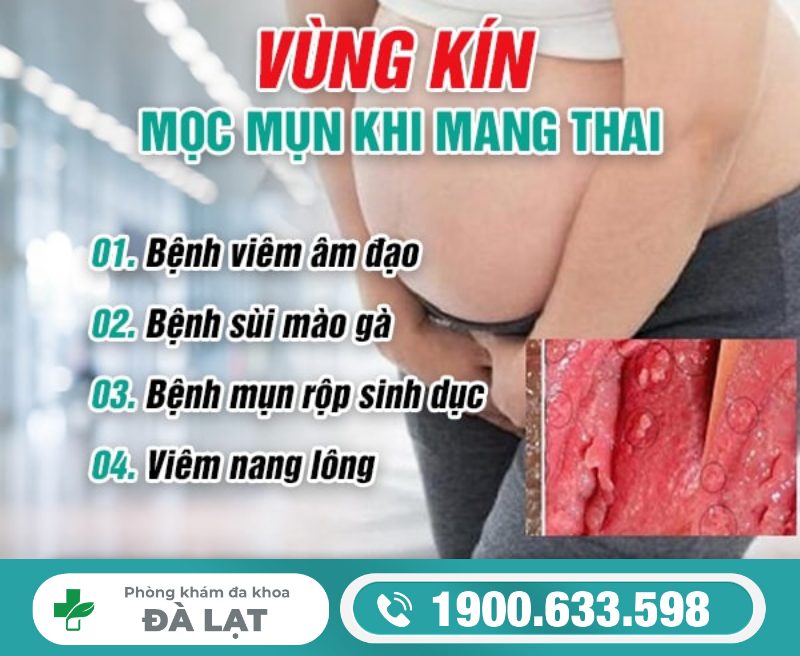 MỌC MỤN VÙNG KÍN KHI MANG THAI DO ĐÂU?