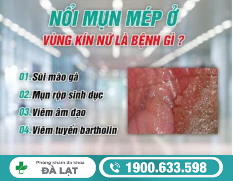 NAM VÀ NỮ BỊ NỔI MỤN ĐỎ Ở MÉP VÙNG KÍN 