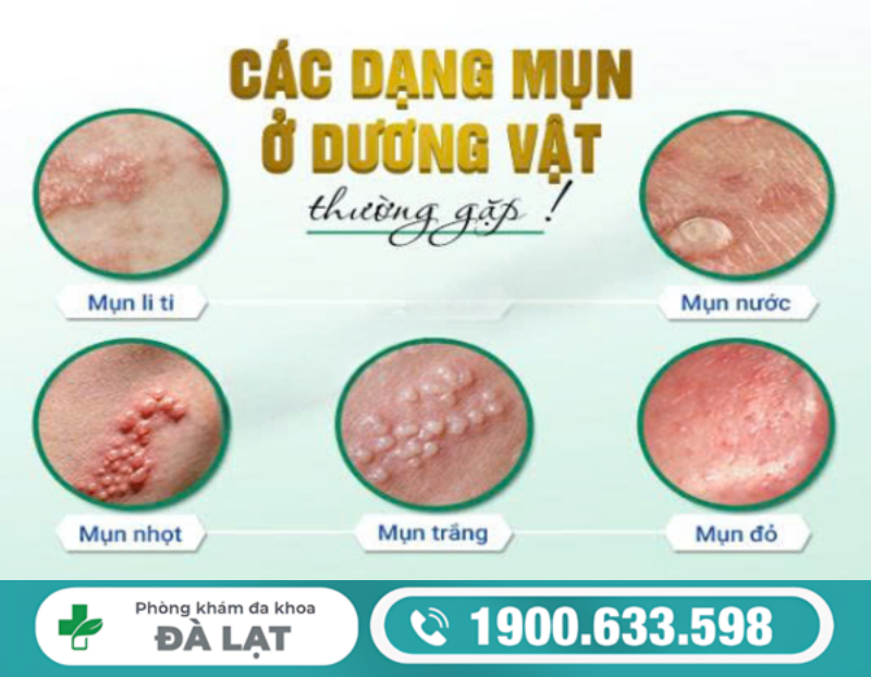 MỌC MỤN MỦ Ở CẬU NHỎ: NGUYÊN NHÂN THƯỜNG GẶP VÀ MỨC ĐỘ NGUY HIỂM 