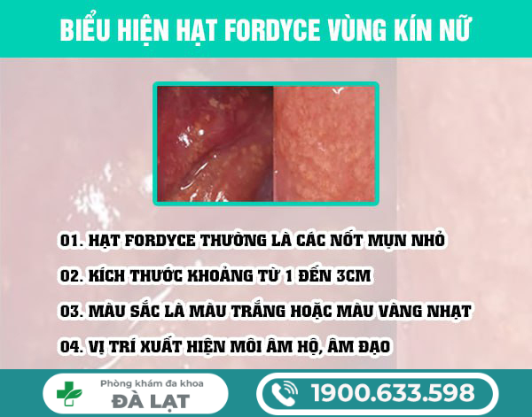 Tìm Hiểu Về: Hạt Fordyce Ở Vùng Kín Nữ Giới 