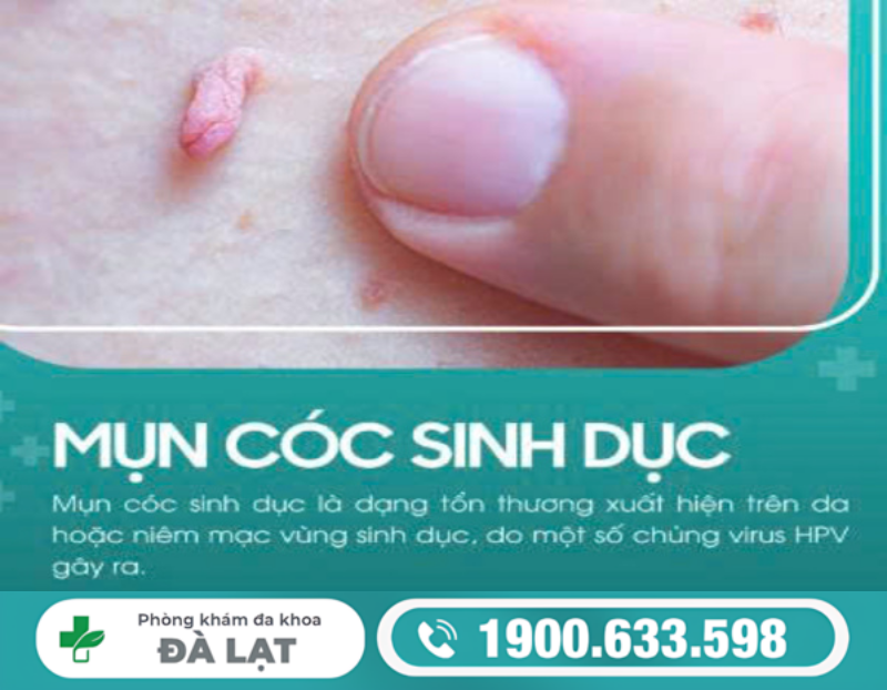 MỤN CÓC SINH DỤC: NHẬN BIẾT SỚM ĐÊ TRÁNH BIẾN CHỨNG