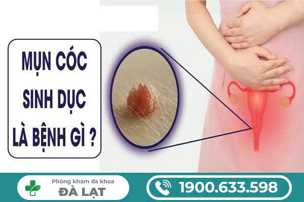 NHẬN BIẾT MỤN CÓC SINH DỤC QUA HÌNH ẢNH VÀ BIỂU HIỆN THƯỜNG GẶP