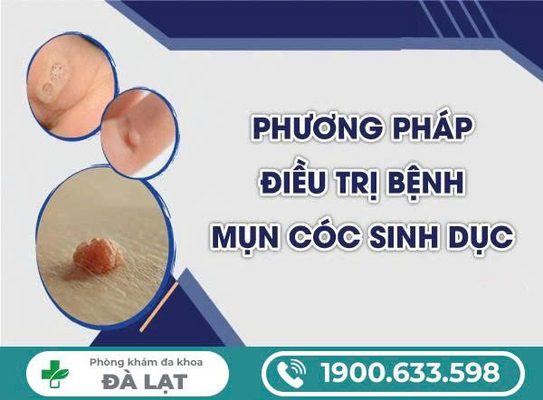 CÁCH CHỮA MỤN CÓC SINH DỤC HIỆU QUẢ HIỆN NAY 