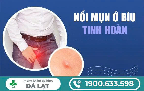 Mọc Mụn Ở Bìu Tinh Hoàn 