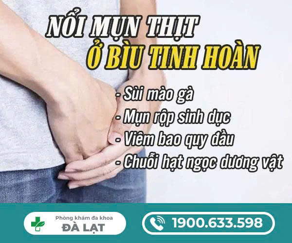 Mụn Thịt Ở Bìu Tinh Hoàn 