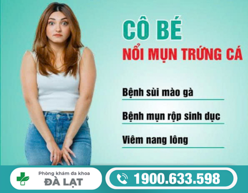 CÔ BÉ BỊ NỔI MỤN TRỨNG CÁ LÀ DẤU HIỆU BỆNH GÌ?
