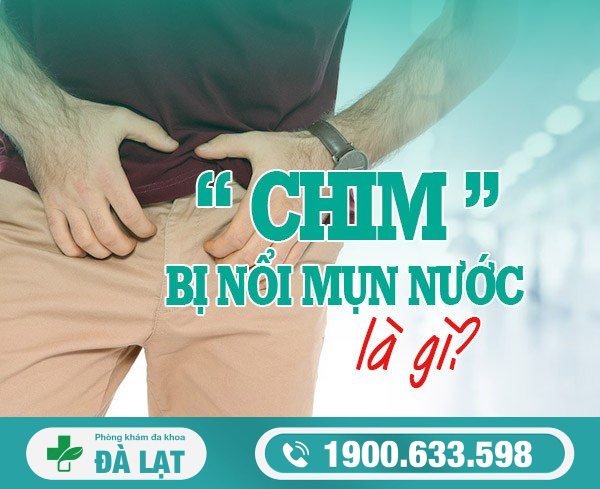 Hiện Tượng: Chim Bị Nổi Mụn Nước Ở Nam Giới 