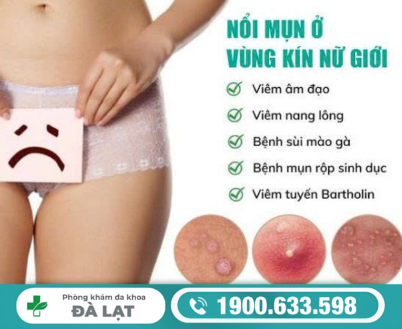 GIẢI ĐÁP: CÔ BÉ MỌC MỤN CÓ SAO KHÔNG?