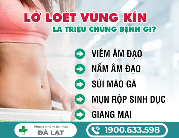 CÁCH TRỊ VIÊM LOÉT VÙNG KÍN AN TOÀN VÀ HIỆU QUẢ