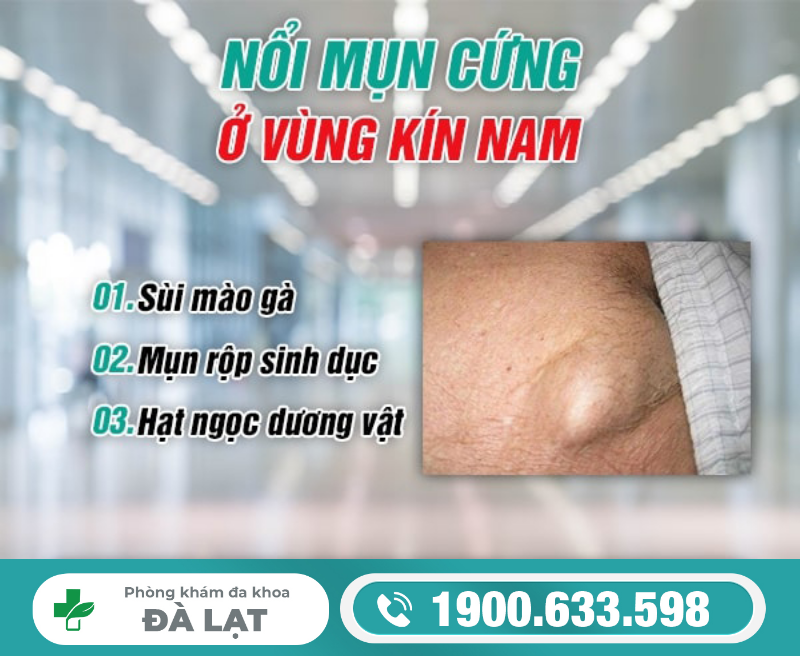 CÁCH CHỮA MỤN CỨNG Ở VÙNG KÍN