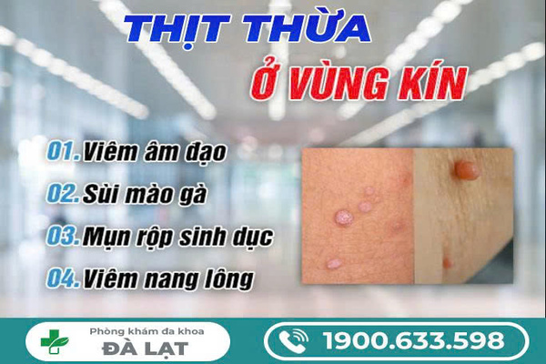 GIẢI ĐÁP: NỔI THỊT THỪA Ở VÙNG KÍN NAM VÀ NỮ? 