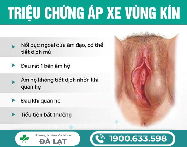 MỤN ÁP XE Ở VÙNG KÍN