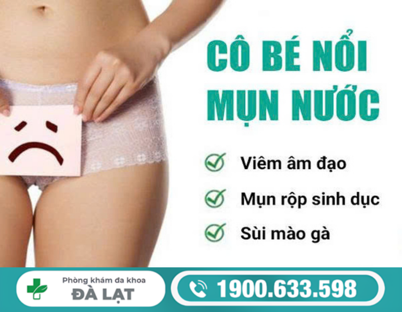 NỔI MỤN NƯỚC Ở MÔI BÉ DO ĐÂU?
