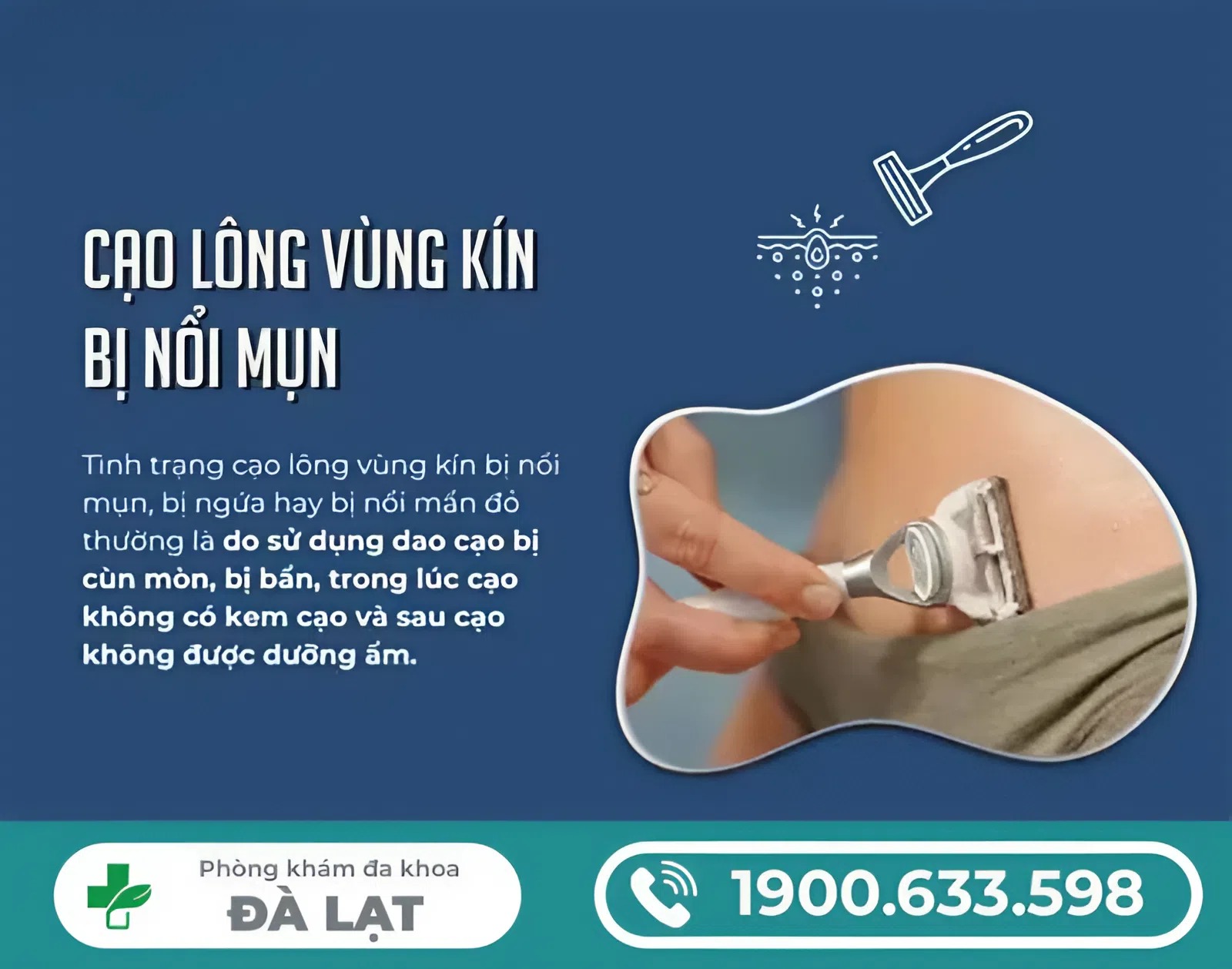 CẠO LÔNG VÙNG KÍN BỊ LÊN MỤN
