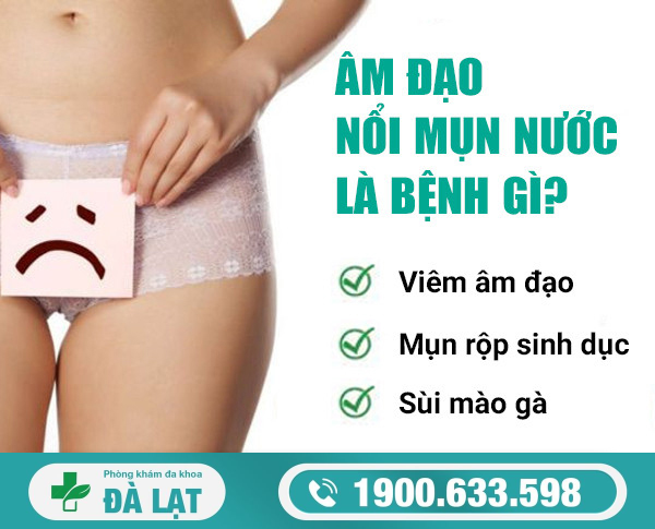Âm Đạo Bị Nổi Mụn Nước ở Nữ Giới 