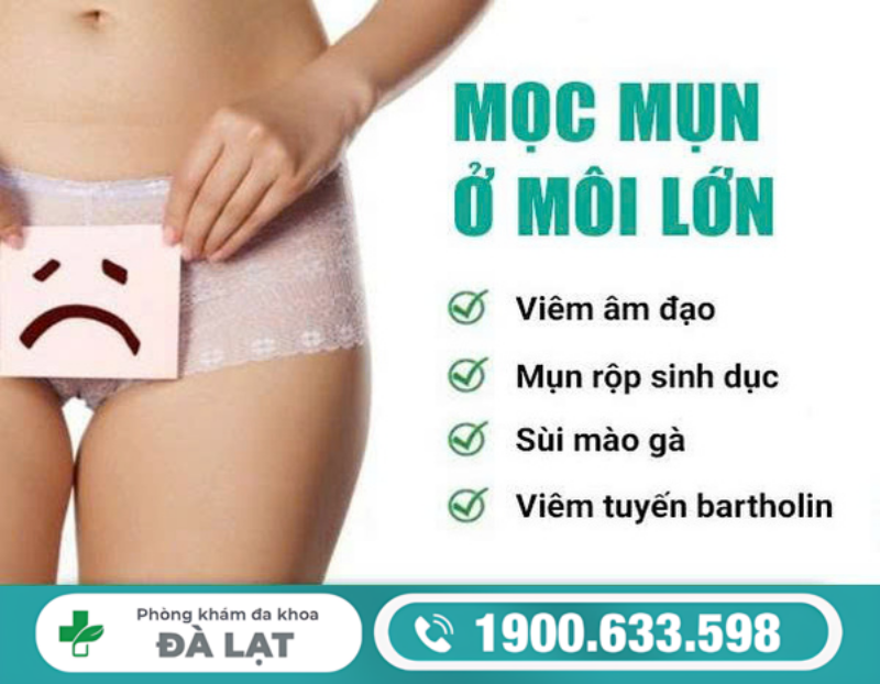 MỌC MỤN Ở MÔI LỚN CẢNH BÁO BỆNH GÌ?
