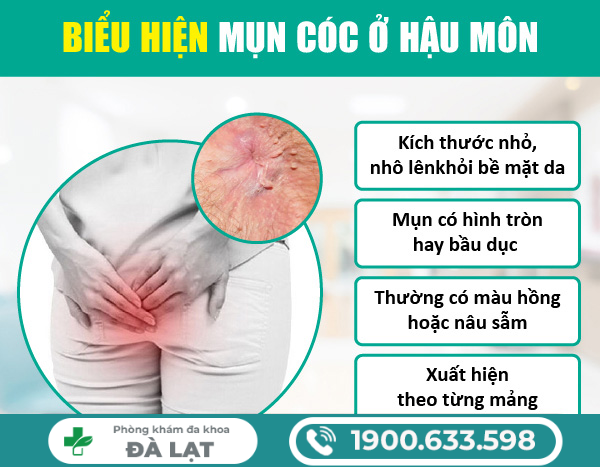 MỤN CÓC Ở HẬU MÔN