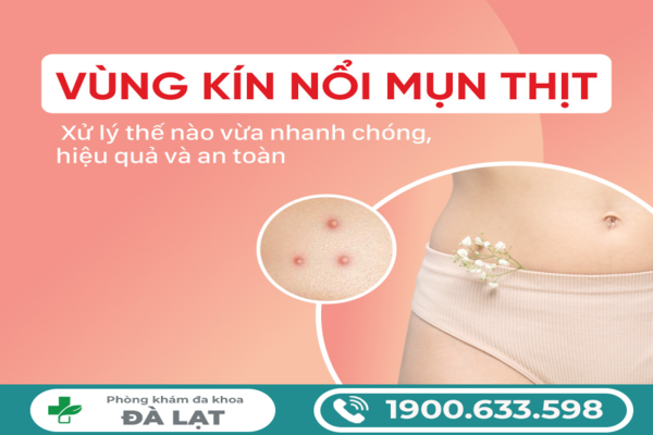 Nổi Mụn Thịt Ở Cửa Mình Nữ Giới 