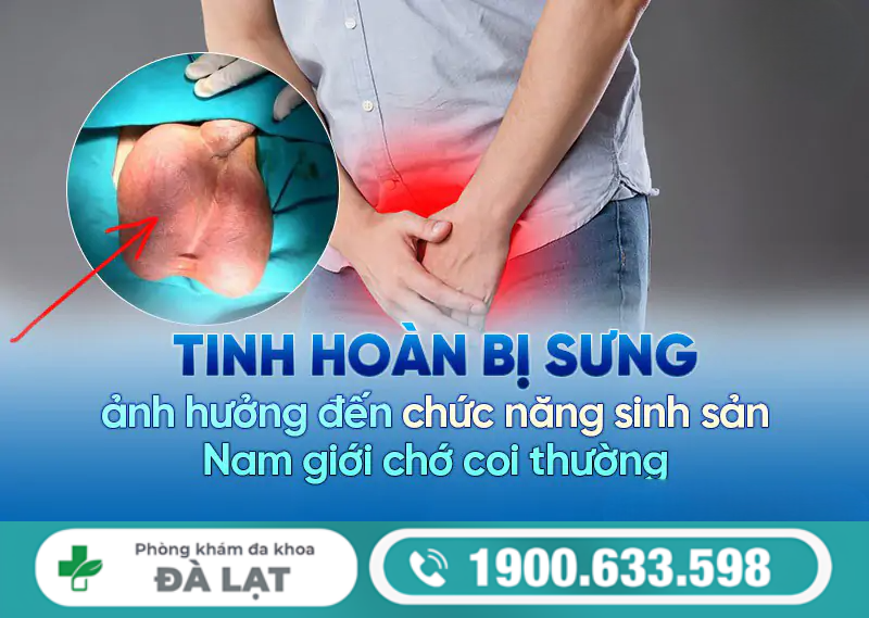 TINH HOÀN BỊ SƯNG CẢNH BÁO BỆNH NAM KHOA NÀO?