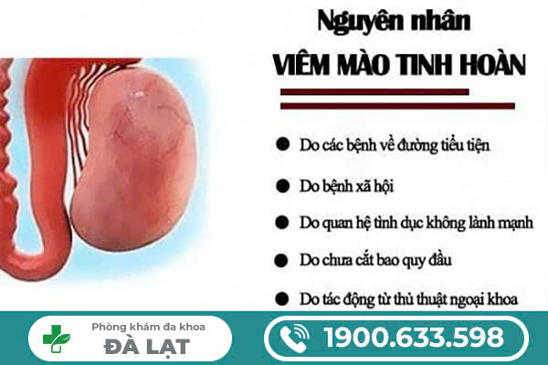 CÁC NGUYÊN NHÂN GÂY VIÊM TINH HOÀN HIỆN NAY