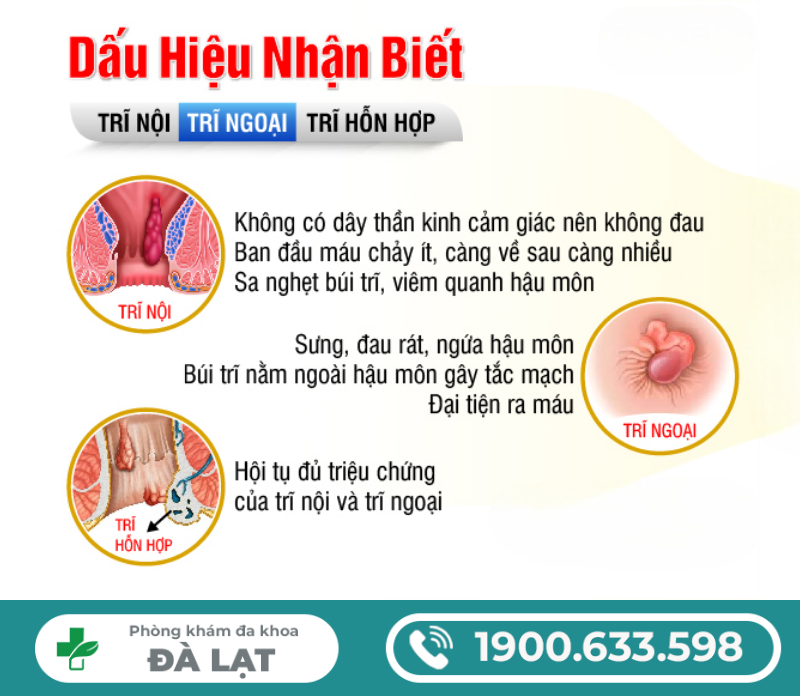 BỆNH TRĨ LÀ GÌ? NGUYÊN NHÂN, DẤU HIỆU VÀ CÁCH ĐIỀU TRỊ