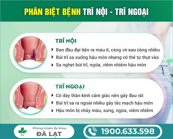 SƯNG, ĐAU BÚI TRĨ – CÁCH ĐIỀU TRỊ HIỆU QUẢ