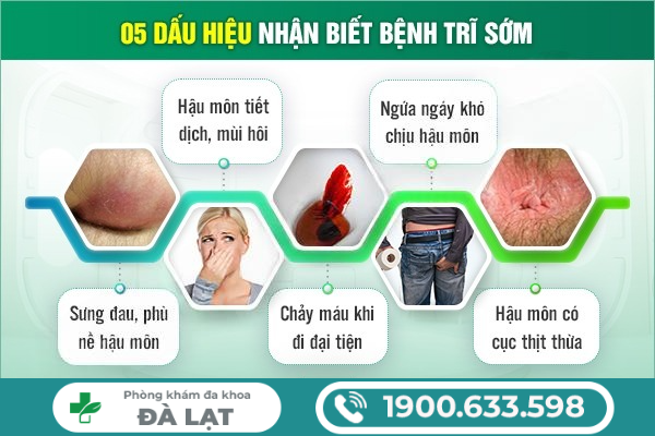 BỆNH TRĨ TÁI PHÁT – DẤU HIỆU BỆNH CẦN ĐIỀU TRỊ NGAY