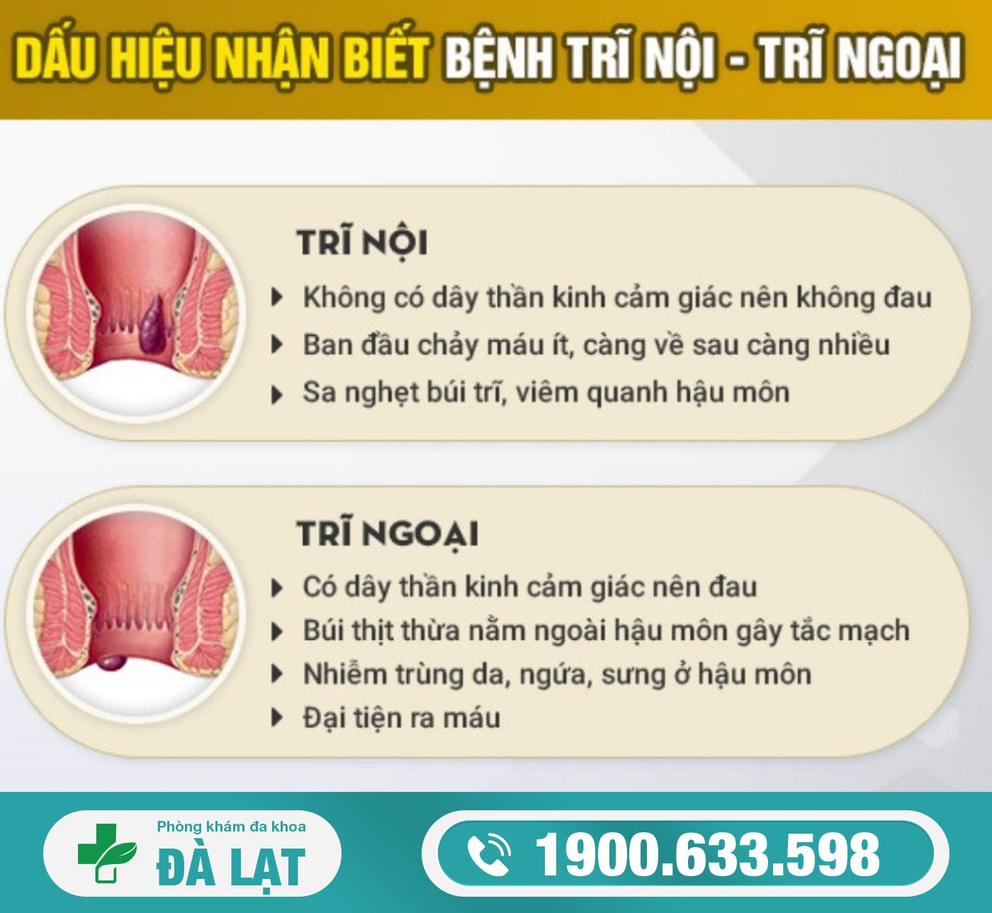 TRĨ NỘI: NGUYÊN NHÂN, DẤU HIỆU VÀ CÁCH ĐIỀU TRỊ HIỆU QUẢ 