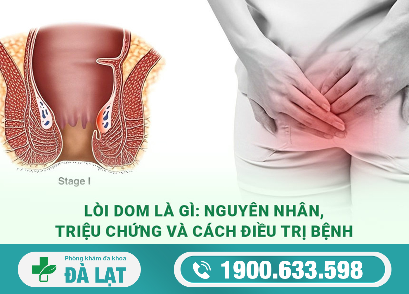 TÌM HIỂU VỀ LÒI TRĨ VÀ CÁCH ĐIỀU TRỊ HIỆU QUẢ 