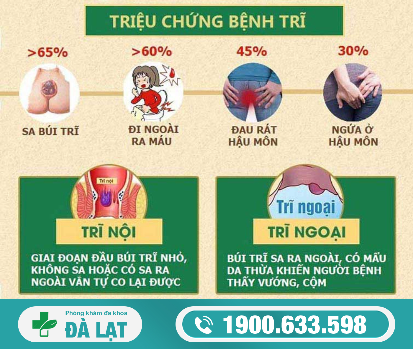 MỔ TRĨ: KHI NÀO NGƯỜI BỆNH CẦN THỰC HIỆN?