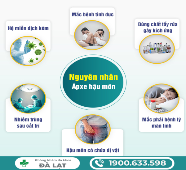 TÌM HIỂU CHỮA ÁP XE HẬU MÔN Ở ĐÂU HIỆU QUẢ    