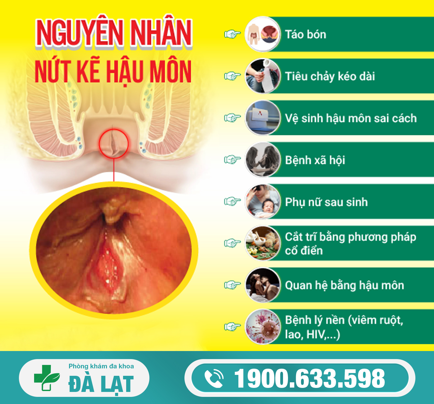 TÌM HIỂU CÁC NGUYÊN NHÂN GÂY NỨT KẼ HẬU MÔN THƯỜNG GẶP   