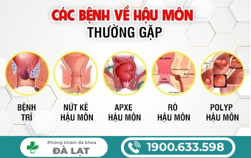 CÁC BỆNH HẬU MÔN THƯỜNG GẶP 